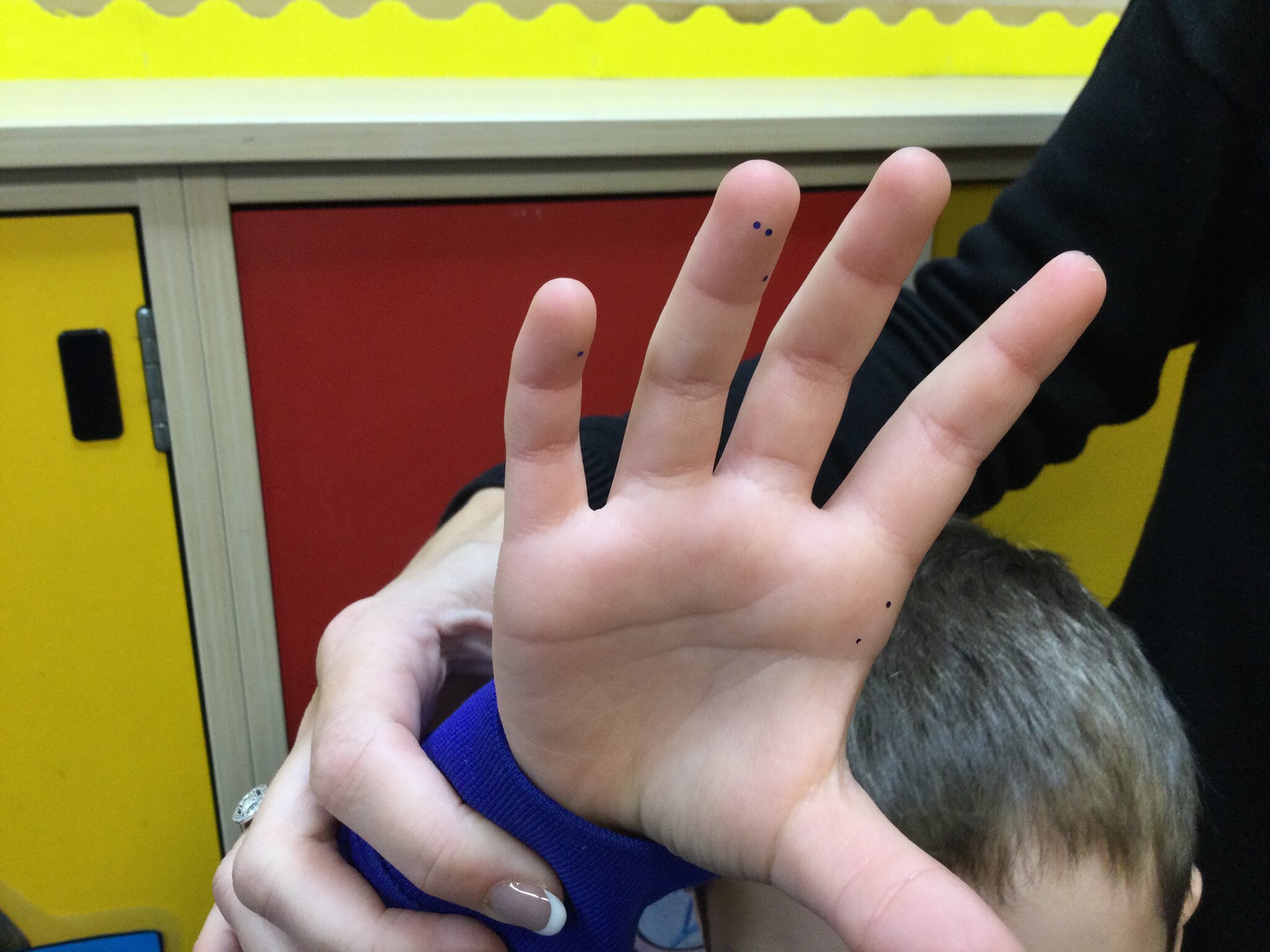 Image of Horrid Hands