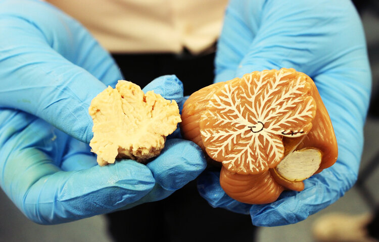 Image of Brain Day 2016