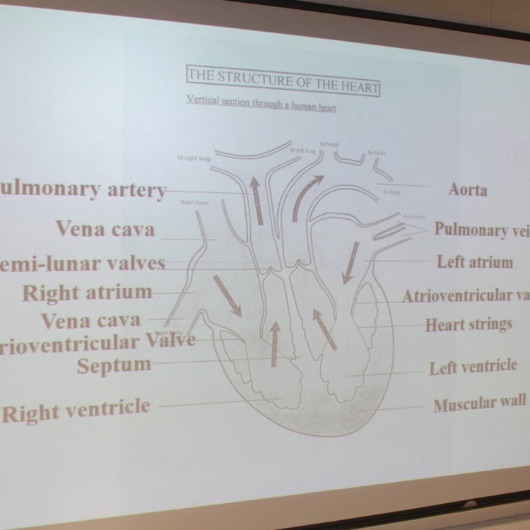 Image of Third Year Heart Dissection