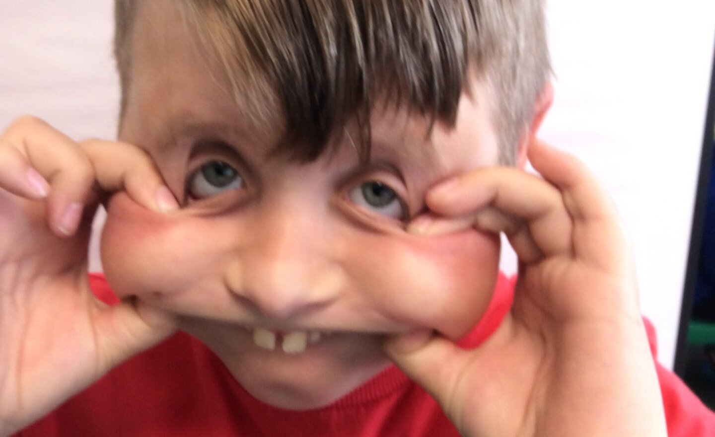 Image of Red Nose Fun