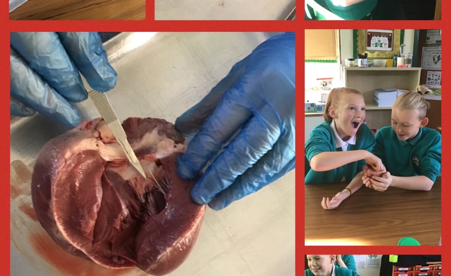 Image of Heart Dissection! 