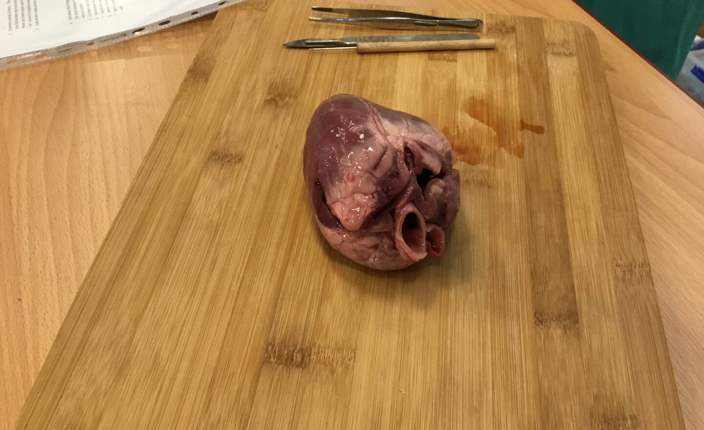 Image of Heart Dissection!