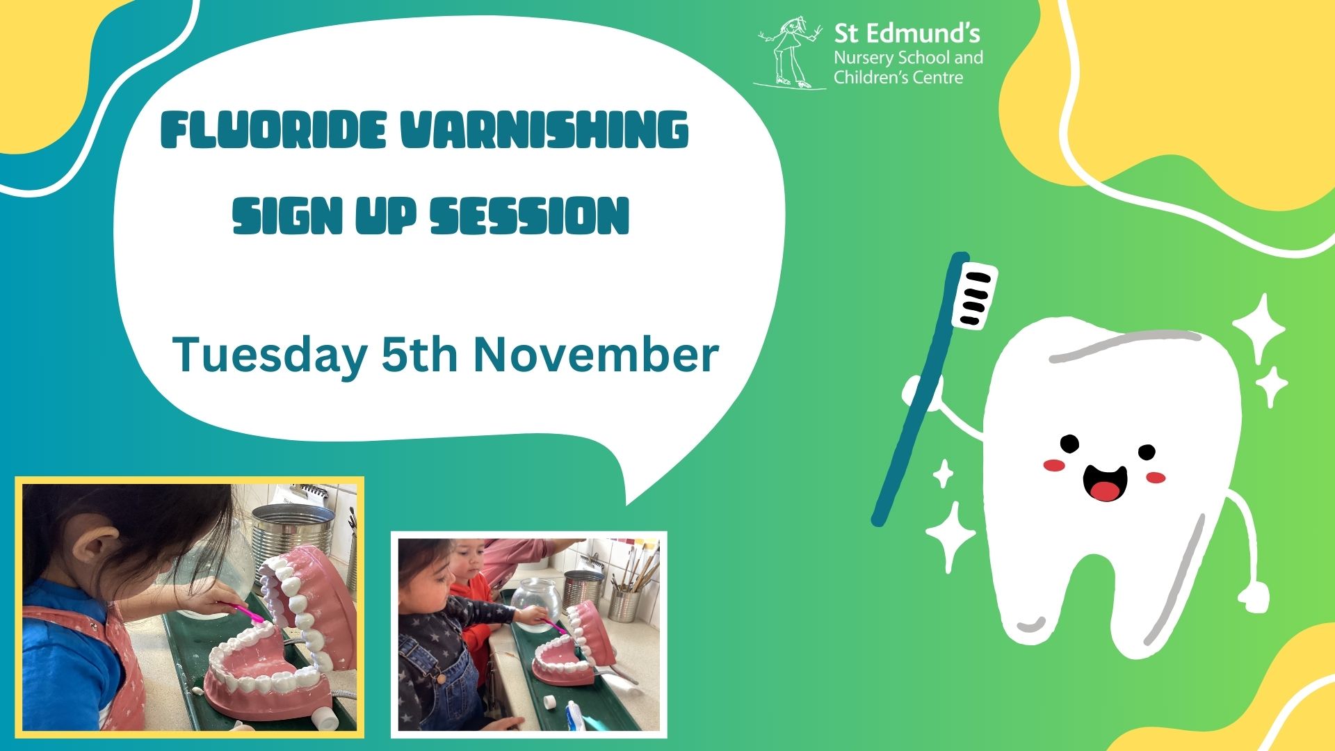 Image of Fluoride Varnish Sign Up Session 